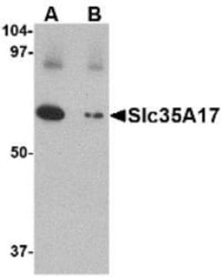 Novus Biologicals&trade;&nbsp;SLC22A17 Antibody Blocking Peptide