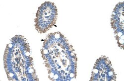 SLC22A1 Antibody, Novus Biologicals 0.1mg; Unlabeled:Antibodies, Polyclonal