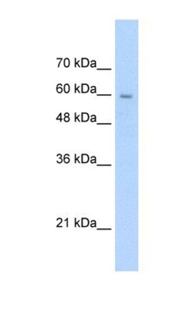 SLC22A1 Antibody, Novus Biologicals 0.1mg; Unlabeled:Antibodies, Polyclonal