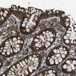 SLC22A23 Antibody, Novus Biologicals 0.1mL; Unlabeled:Antibodies, Polyclonal