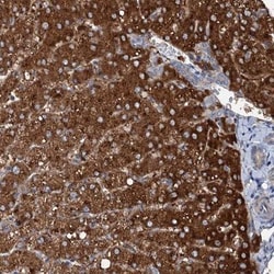 SLC22A25 Antibody, Novus Biologicals 0.1mL; Unlabeled:Antibodies, Polyclonal