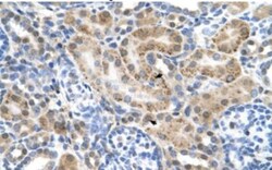 SLC22A3 Antibody, Novus Biologicals 0.05mg; Unlabeled:Antibodies, Polyclonal