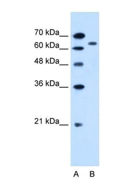 SLC22A3 Antibody, Novus Biologicals 0.05mg; Unlabeled:Antibodies, Polyclonal