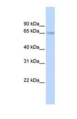 SLC22A6 Antibody, Novus Biologicals 100 &mu;L | Buy Online | Novus Biologicals | Fisher Scientific