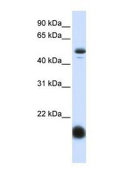 SLC22A7 Antibody, Novus Biologicals 0.05mg; Unlabeled:Antibodies, Polyclonal