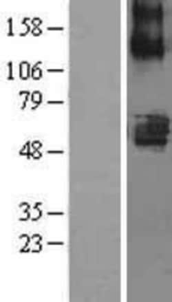 Novus Biologicals™ SLC22A7 Overexpression Lysate