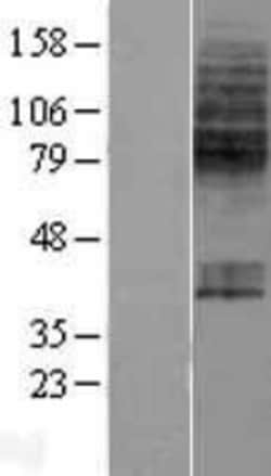 Novus Biologicals&trade;&nbsp;SLC23A1 Overexpression Lysate