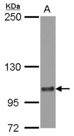 SLC24A1 Antibody, Novus Biologicals 0.1mL; Unlabeled:Antibodies, Polyclonal