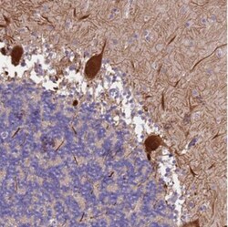 SLC24A3 Antibody, Novus Biologicals:Antibodies:Primary Antibodies