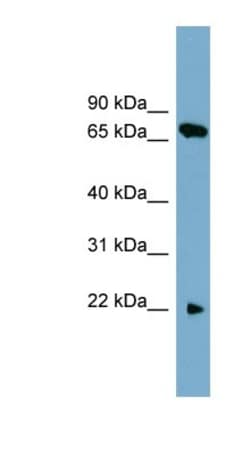 SLC24A4 Antibody, Novus Biologicals 100 &mu;L | Buy Online | Novus Biologicals | Fisher Scientific