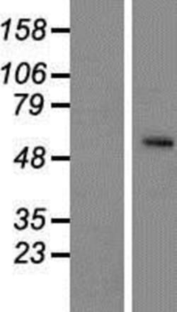 Novus Biologicals™ SLC24A5 Overexpression Lysate