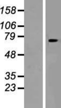 Novus Biologicals™ SLC24A6 Overexpression Lysate
