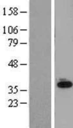 Novus Biologicals&trade;&nbsp;SLC25A11 Overexpression Lysate