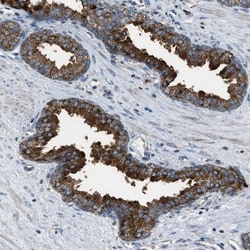 SLC25A11 Antibody, Novus Biologicals 0.1mL; Unlabeled:Antibodies, Polyclonal