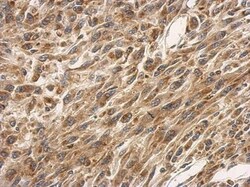 SLC25A11 Antibody, Novus Biologicals 0.1mL; Unlabeled:Antibodies, Polyclonal