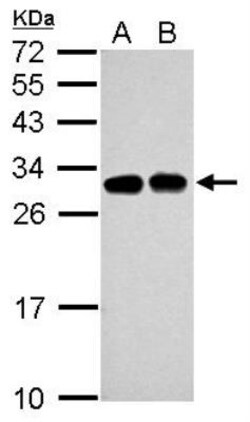 SLC25A11 Antibody, Novus Biologicals 0.1mL; Unlabeled:Antibodies, Polyclonal