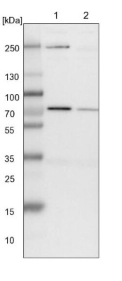 SLC25A12 Antibody, Novus Biologicals 0.1mL; Unlabeled:Antibodies, Polyclonal
