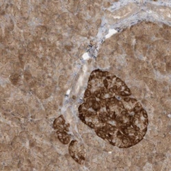 SLC25A12 Antibody, Novus Biologicals 0.1mL; Unlabeled:Antibodies, Polyclonal