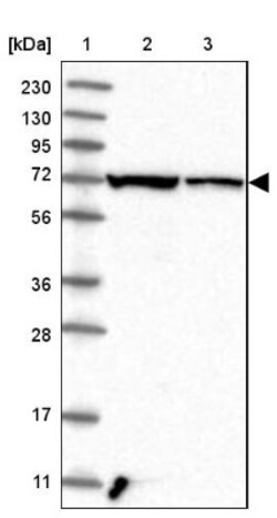 SLC25A12 Antibody, Novus Biologicals 0.1mL; Unlabeled:Antibodies, Polyclonal