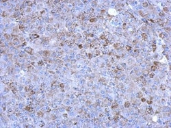 SLC25A15 Antibody, Novus Biologicals 0.1mL; Unlabeled:Antibodies, Polyclonal