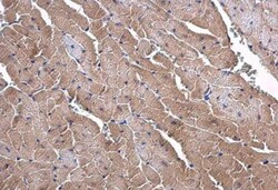 SLC25A15 Antibody, Novus Biologicals 0.1mL; Unlabeled:Antibodies, Polyclonal