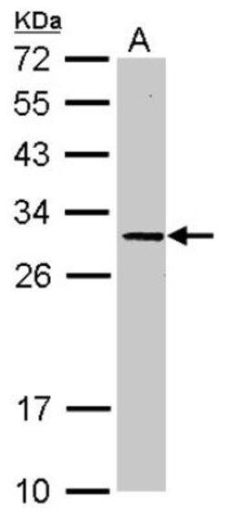 SLC25A15 Antibody, Novus Biologicals 0.1mL; Unlabeled:Antibodies, Polyclonal
