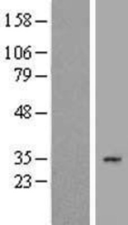 Novus Biologicals&trade;&nbsp;SLC25A2 Overexpression Lysate