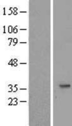 Novus Biologicals&trade;&nbsp;SLC25A20 Overexpression Lysate