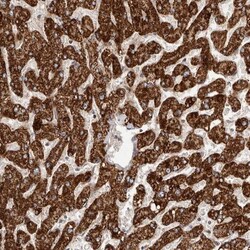 DLX5 Antibody, Novus Biologicals:Antibodies:Primary Antibodies