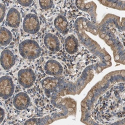 SLC25A20 Antibody, Novus Biologicals 0.1mL; Unlabeled:Antibodies, Polyclonal