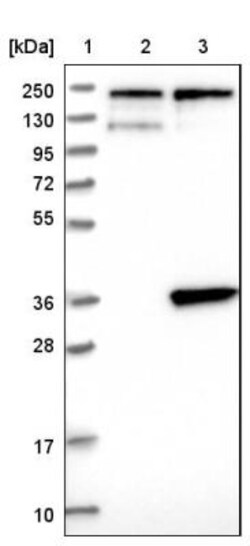 SLC25A20 Antibody, Novus Biologicals 0.1mL; Unlabeled:Antibodies, Polyclonal