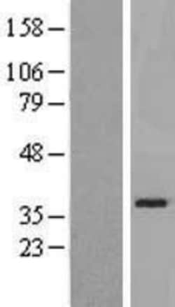 Novus Biologicals™ SLC25A21 Overexpression Lysate