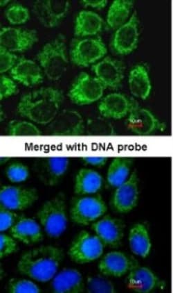 SLC25A22 Antibody, Novus Biologicals 0.1mg; Unlabeled:Antibodies, Polyclonal