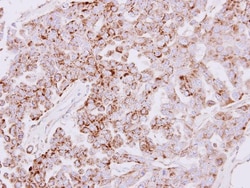 SLC25A22 Antibody, Novus Biologicals 0.1mg; Unlabeled:Antibodies, Polyclonal