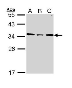 SLC25A22 Antibody, Novus Biologicals 0.1mg; Unlabeled:Antibodies, Polyclonal