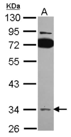 SLC25A22 Antibody, Novus Biologicals 0.1 mL | Buy Online | Novus Biologicals | Fisher Scientific