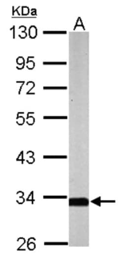 SLC25A22 Antibody, Novus Biologicals 0.1 mL | Buy Online | Novus Biologicals | Fisher Scientific