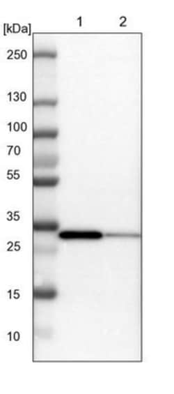 SLC25A22 Antibody, Novus Biologicals:Antibodies:Primary Antibodies