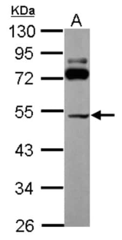 SLC25A23 Antibody, Novus Biologicals 0.1mL; Unlabeled:Antibodies, Polyclonal