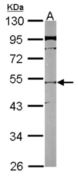 SLC25A23 Antibody, Novus Biologicals 0.1mL; Unlabeled:Antibodies, Polyclonal