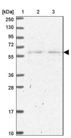 SLC25A23 Antibody, Novus Biologicals 25 &mu;L, Unlabeled:Antibodies, Polyclonal