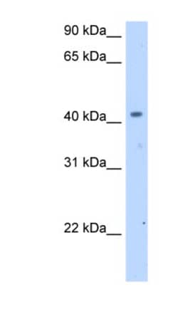 SLC25A24 Antibody, Novus Biologicals:Antibodies:Primary Antibodies