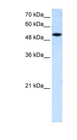 SLC25A25 Antibody, Novus Biologicals 0.05mg; Unlabeled:Antibodies, Polyclonal
