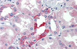 SLC25A28 Antibody, Novus Biologicals 0.05mg; Unlabeled:Antibodies, Polyclonal
