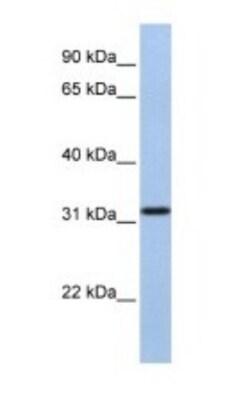SLC25A28 Antibody, Novus Biologicals 0.05mg; Unlabeled:Antibodies, Polyclonal