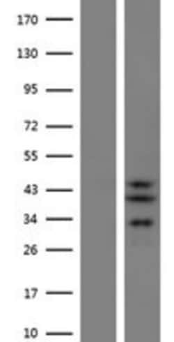Novus Biologicals™ SLC25A28 Overexpression Lysate
