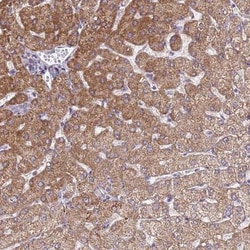 SLC25A15 Antibody, Novus Biologicals 25 &mu;L, Unlabeled:Antibodies, Polyclonal