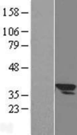 Novus Biologicals&trade;&nbsp;SLC25A3 Overexpression Lysate