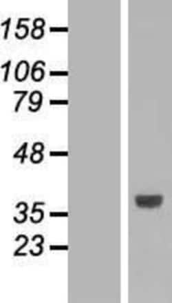 Novus Biologicals&trade;&nbsp;SLC25A3 Overexpression Lysate