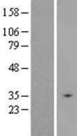Novus Biologicals&trade;&nbsp;SLC25A31 Overexpression Lysate
